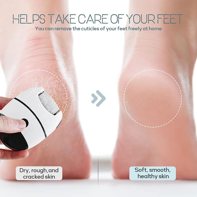 Electric Callus Remover for Feet, Portable Pedicure Tools for feet, 2-Speed Foot Callus Remover, 3Rollers Foot File Electric, feet Scrubber Dead Skin, Foot Grinder Dead Skin Removal for feet