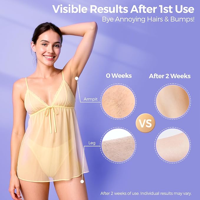 2026 Upgraded Laser Hair Removal with 5℃ Ice Cooling, Painless IPL Laser Hair Removal Device for Women & Men, 999,999 Flashes, 5 Levels, 2 Modes, Permanent At-Home Hair Removal for Face & Body
