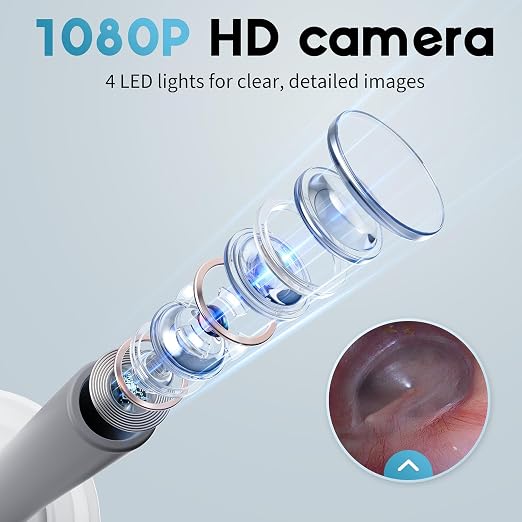 Otoscope Ear Camera with 1.21” Screen, 1080P Ear Scope with 4 LED Lights, Otoscope Camera for Adults, Support Photo & Video, Type-C Charging with Computers, Baby Essentials, Home Medical | 1.21" Screen for real-time viewing. Capture photos and videos, ...