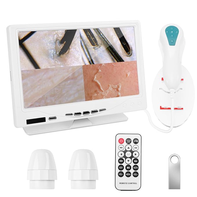 Beauty Star 7-Inch Scalp & Skin Analyzer with 50X/200X Dual Lenses, 4-Split View & 16GB Storage – HD Trichology Microscope Camera for Professional Salon, Head Spa, and Home Hair Follicle Health