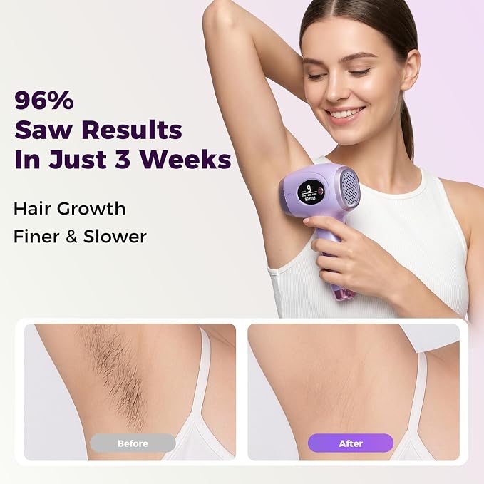 Ufree IPL Hair Removal Device, Full Body for Women Men at Home, Long-Lasting & Painless, 20J & 3 Smart Modes, 990k Flashes, Hair Remover for Armpits Legs Arms Face Bikini Line (Purple)