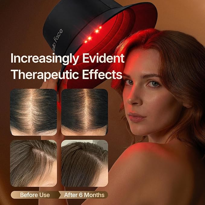 Red Light Therapy Hair Growth Cap, 336 Chips 660nm & 850nm Near Infrared, Discreet Fisherman Hat Design Fits Up to 24.4 Inches, Professional Red Light Therapy for Full Scalp Coverage