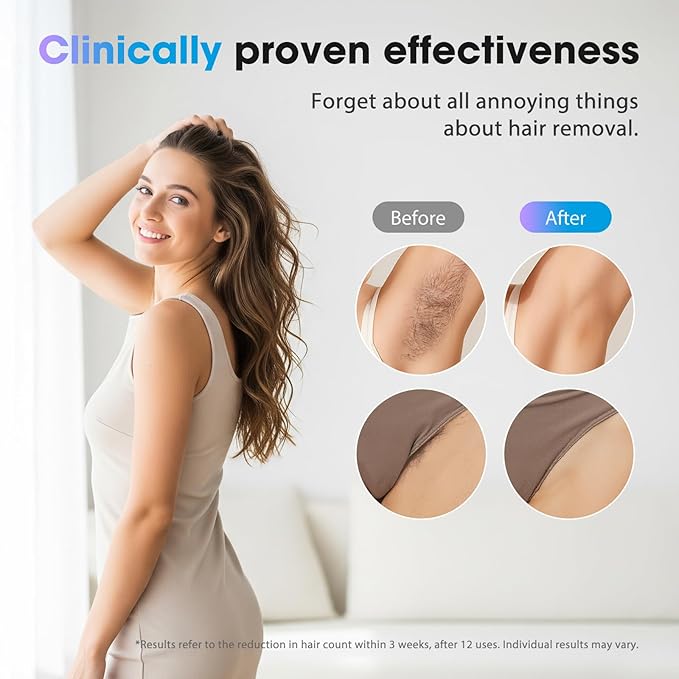 IPL Laser Hair Removal Device for Women & Men - Home 45°F Ice-Cooling Contact for Painless & Long-Lasting Results, 86% Hair Reduction in 3 Weeks for Full Body & Bikini Line, White