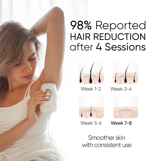 Sensica IPL Hair Removal Device – IPL030 Sensilight MINI, At-Home Plug-In for Women & Men, 3 Energy Levels, Built-In Safety Sensors, Precision Window for Face & Body, Compact Travel-Friendly