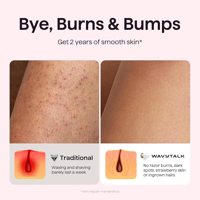 Wavytalk IPL Hair Removal Device, Bare It with Precision Roller for Face Body Bikini – Long-Lasting & Painless, 24J Dual-Pulse & Ice Cooling, At-Home Use for Women and Men, Corded