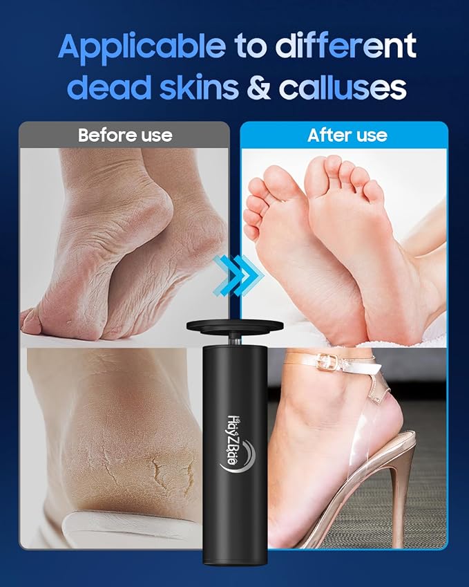 HayZBao Electric Foot Callus Remover with 60 Pcs Sandpaper Discs + 60 Pcs Sandpape Set (Black)