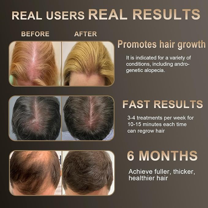 Laser Hair Growth Comb – 650nm Red Light Therapy, Hair Regrowth Device for Men & Women, FDA-Approved Hair Loss Solution, Cordless Head Spa for Fuller-Looking Hair, White