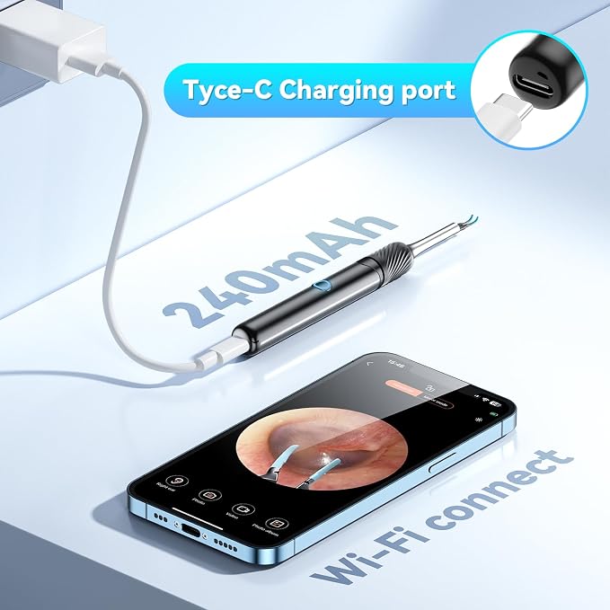 Ear Wax Removal, Ear Camera with Omnidirectional Tweezers, Otoscope with 1080P Camera, Ear Wax Removal Kit with 6 Ear Pick