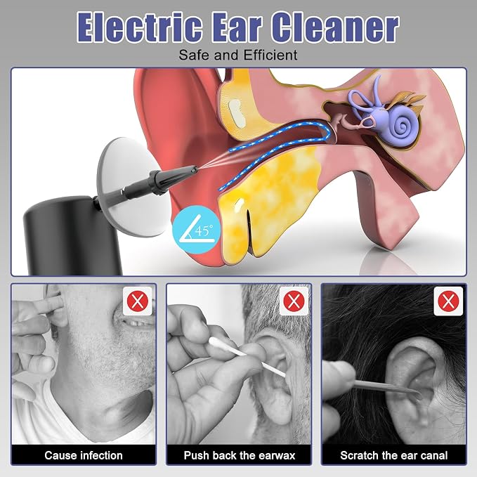 Electric Ear Wax Removal Kit, Ear Irrigation Flushing System with 4 Pressure Settings, Rechargerable, Waterproof, Effective Ear Wax Removal Tool