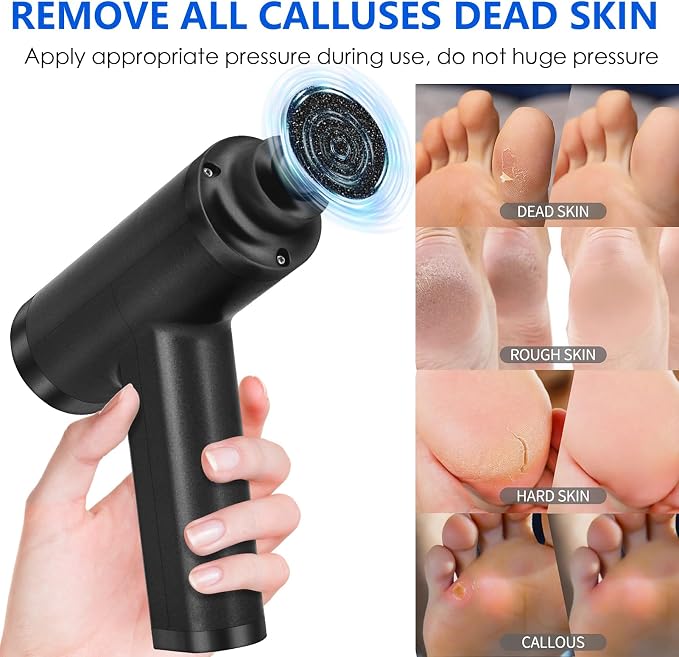 Upgraded Electric Callus Remover for Feet 4500rpm, Adjustable Speed Professional Electric Foot Sander Foot File for Calloused Feet Dead Skin Cracked Heel, with 3 Interchangeable Heads (Black)