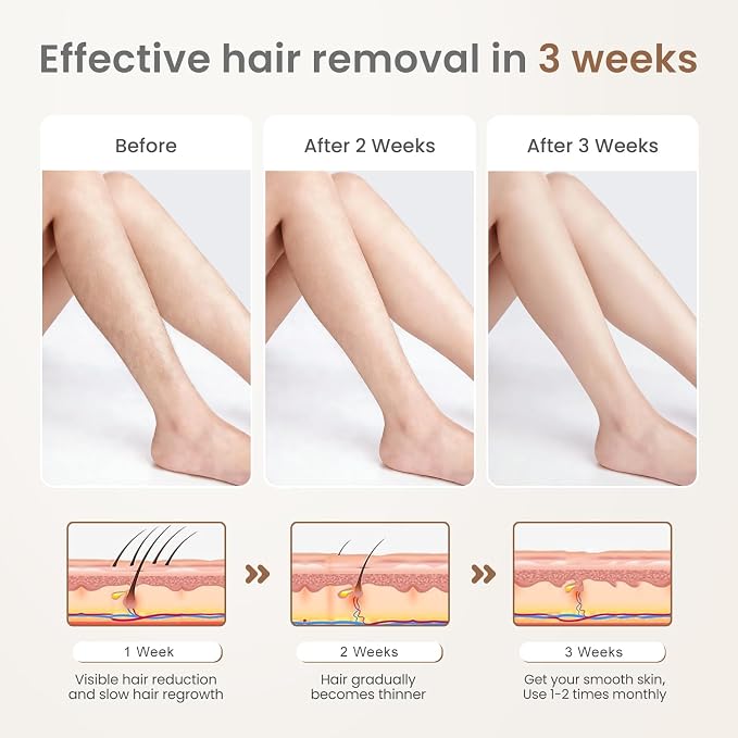 IPL Laser Hair Removal: IPL Laser Hair Removal for Women, Long-Lasting Results,999,999 Flashes Hair Removal at Home, Model S3
