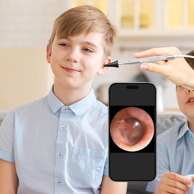 Teslong Digital Otoscope with Light, 1080p HD Ear Camera with Ear Wax Removal Tools, Video Ear Scope Otoscope with Light, Compatible with iPhone15, iPad, Android Phone, USB, Ear Picks, Waterproof