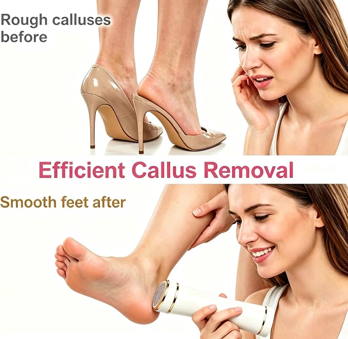 Electric Callus Remover for Feet, Rechargeable Foot File Dry Skin | 2000mAh Battery, IPX7 Waterproof foot shaver, 20 Diamond Rollers, Heel Scraper for Cracked Heels Home Pedicure