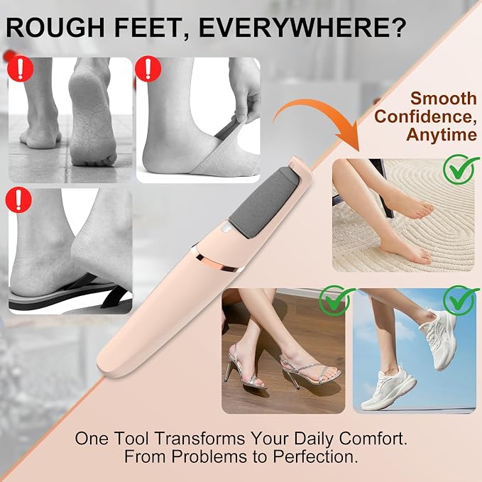Electric Foot File, Callus Remover for Feet - Rechargeable Pedicure Tool, 2 Speeds 1700/2000 RPM & 2 Heads for Dry & Dead Cracked Skin, Cordless Waterproof Hard Skin Removal, Home Pedicure Gift