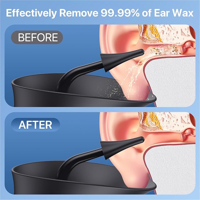 Ear Wax Removal Kit with 200ml Dual Tank, IPX6 Waterproof Ear Cleaner for Home Use, 4 Modes & Warm Water Temperature Sensor