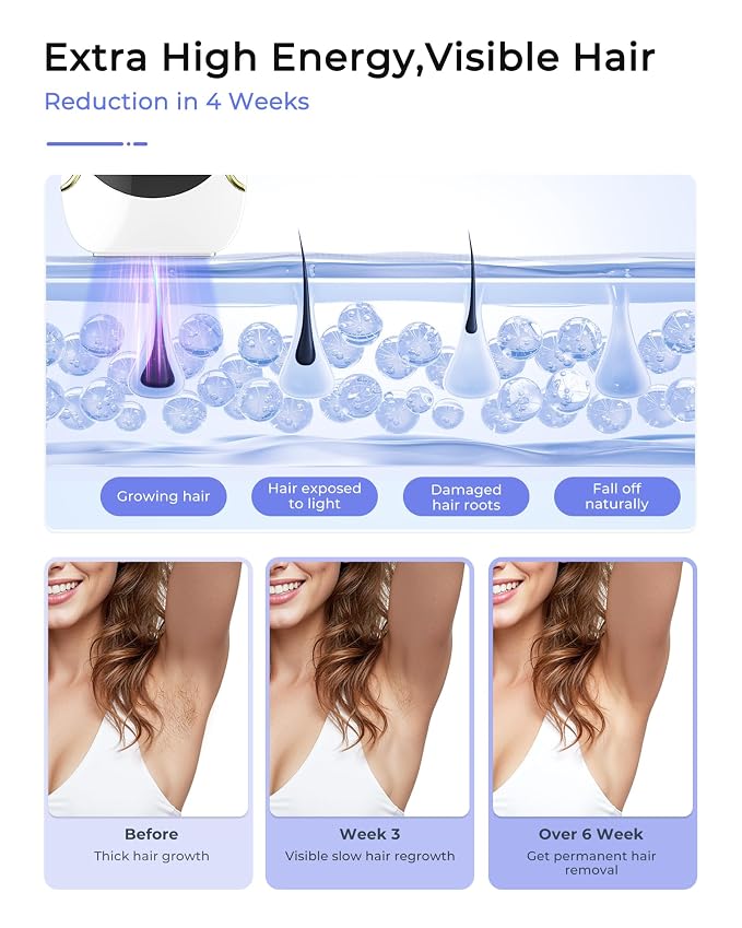 Finequin Laser Hair Removal for Women and Men, Air 15 Ice-cooling IPL Device Hair Removal for Nearly Painless & Long-Lasting Results From Home, 3 Modes & Auto Flashing for Fast Full Body Hair Removal