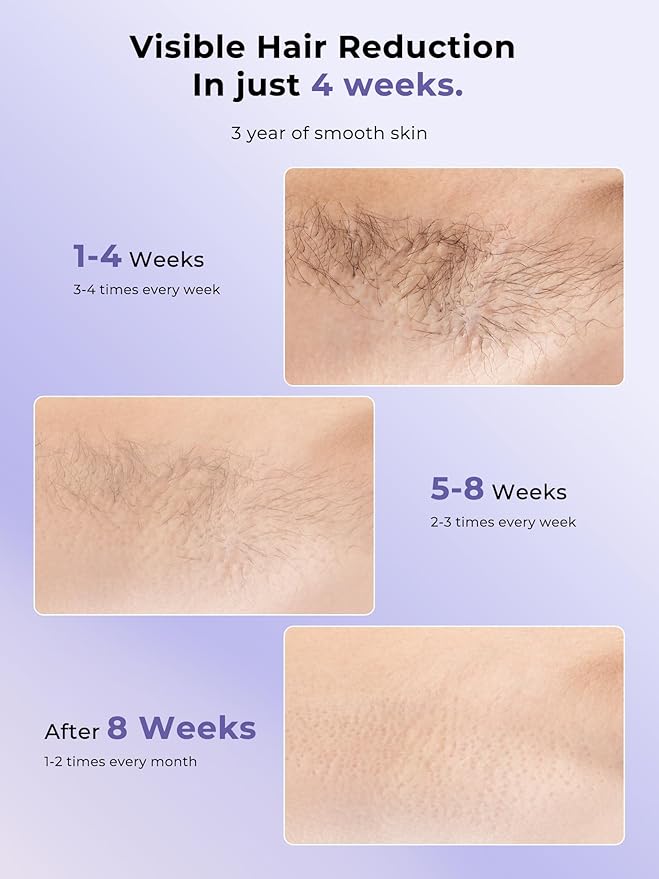 Ubroo Laser Hair Removal with 5℃ Ice Cooling,Hand-held Hair Removal Device IPL Hair Removal for Women and Men,Reduce Hair Regrowth,Full Body Use for Legs,Bikini,Armpits（Purple）
