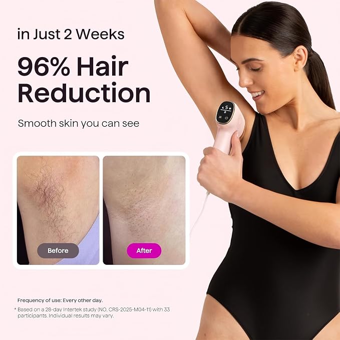 Wavytalk IPL Hair Removal Device, Bare It with Precision Roller for Face Body Bikini – Long-Lasting & Painless, 24J Dual-Pulse & Ice Cooling, At-Home Use for Women and Men, Corded
