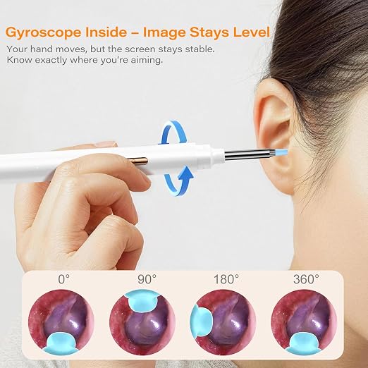 Ear Wax Removal Tool Camera with Screen, Smart Screen Ear Wax Removal Kit with 2.8'' HD Display, WiFi Automatic Connect - Ear Cleaner Tool with Camera&Screen, 6 Replaceable Tips, No App/Phone Needed