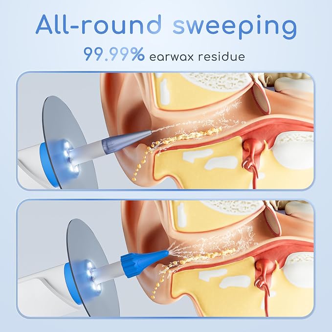 Earwax Removal - Electric Ear Irrigation Kit with 4 Pressure Modes, Ear Cleaner with Camera, 1080P Otoscope, Ear Cleaning Tool with 7-Piece Set, Earwax Removal Kit for Daily Cleaning(White)