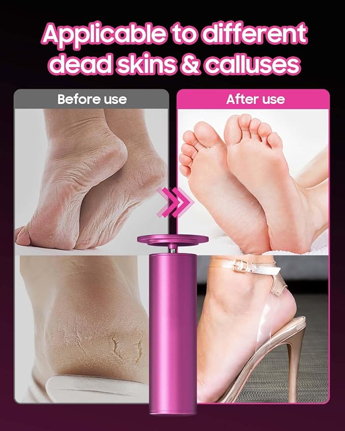 FSA&HSA Electric Foot File - High Torque,Callus Remover for Feet,Adjustable Speed Foot File with 60 Pcs Sandpaper Discs,Professional Pedicure Tool for Dead Skin and Calluses