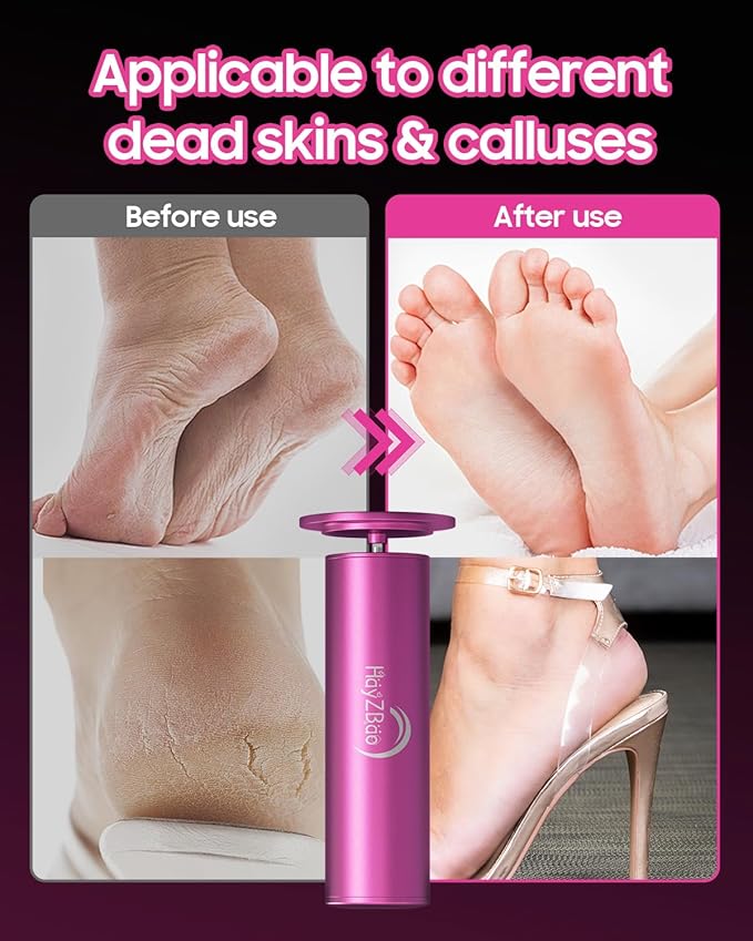 HayZBao Electric Foot Callus Remover with 60 Pcs Sandpaper Discs + 60 Pcs Sandpape Set