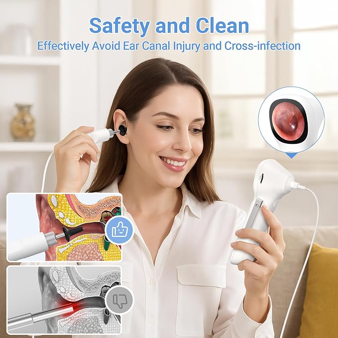 ScopeAround Otoscope with Light, 1.45" IPS Display Digital Otoscope, 3.9mm Ear Camera with Ear Wax Removal Tools, Ear Scope with Extention Cable, 6 LED Lights, Capture Photos Videos, White