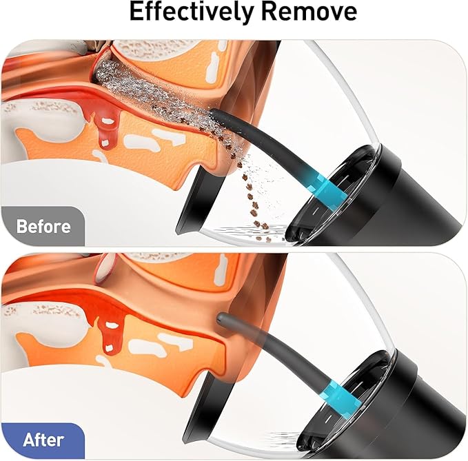 Ear Wax Removal Kit, Electric Ear Cleaner with Ear Irrigation Flushing System, IPX6 Waterproof Ear Cleaning Tool, Automatic Ear Cleaner Earwax Removal for Adults Home Gifts