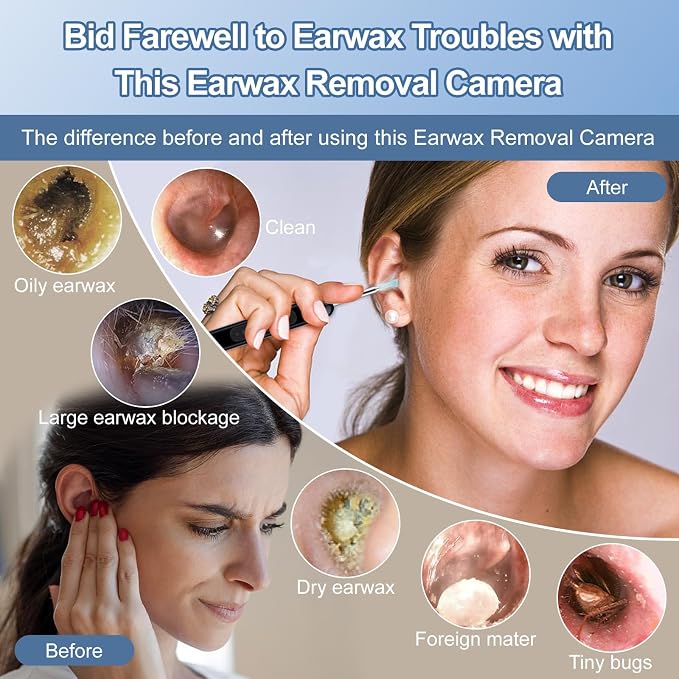 Ear Wax Removal, Ear Wax Removal Kit Tools with 6 LED Lights/IP67 Waterproof Lens/8 Traditional, Ear Cleaner with Camera 1080P HD USB Rechargeable Ear Picker Cleaning kit Black