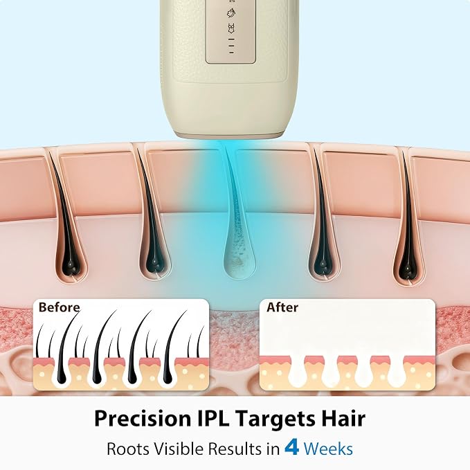 EEK IPL Hair Removal Device, Cool And Painless, Three Modes And Three Power Levels, Suitable For Both Men And Women, Enjoy Beauty Salon-Level Full Body Hair Removal At Home