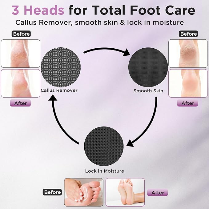 Electric Foot Callus Remover, Apply Oil,Foot File,Reusable Nano-Glass Head, Ergonomic Premium Aluminum Callus Remover for feet, Professional Foot SPA Pedicure Tool at Home