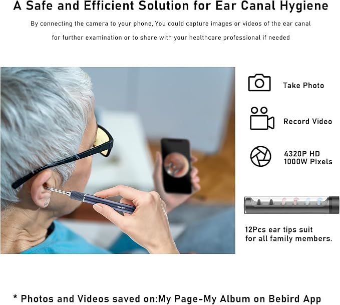Note5 Ear Wax Removal Kit with Camera,10MP Ear Cleaner Camera Otoscope with Light,Real-time Remote Video with Ear Pick & Tweezers,12 Pcs Ear Scoops for Whole Family