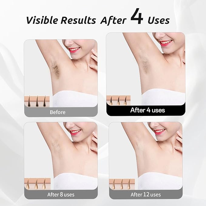 Laser Hair Removal Device for Women and Men, IPL Painless Sapphire with 40F Ice-Cooling System, Safe, Long-Lasting Hair Removal for Home, Face, Legs, Back, Bikini Line