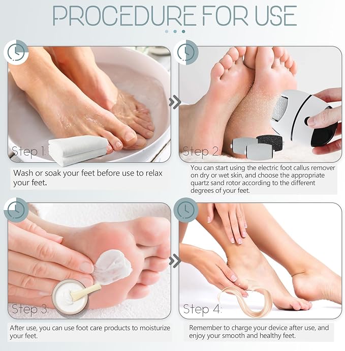 Electric Callus Remover for Feet, Portable Pedicure Tools for feet, 2-Speed Foot Callus Remover, 3Rollers Foot File Electric, feet Scrubber Dead Skin, Foot Grinder Dead Skin Removal for feet
