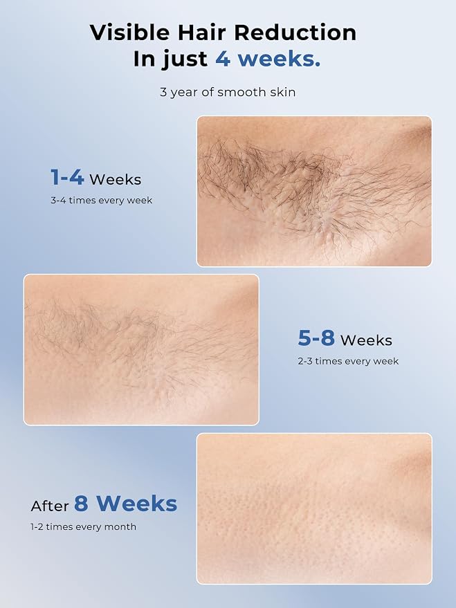 Ubroo Laser Hair Removal with 5℃ Ice Cooling,Hand-held Hair Removal Device IPL Hair Removal for Women and Men,Reduce Hair Regrowth,Full Body Use for Legs,Bikini,Armpits（Blue）
