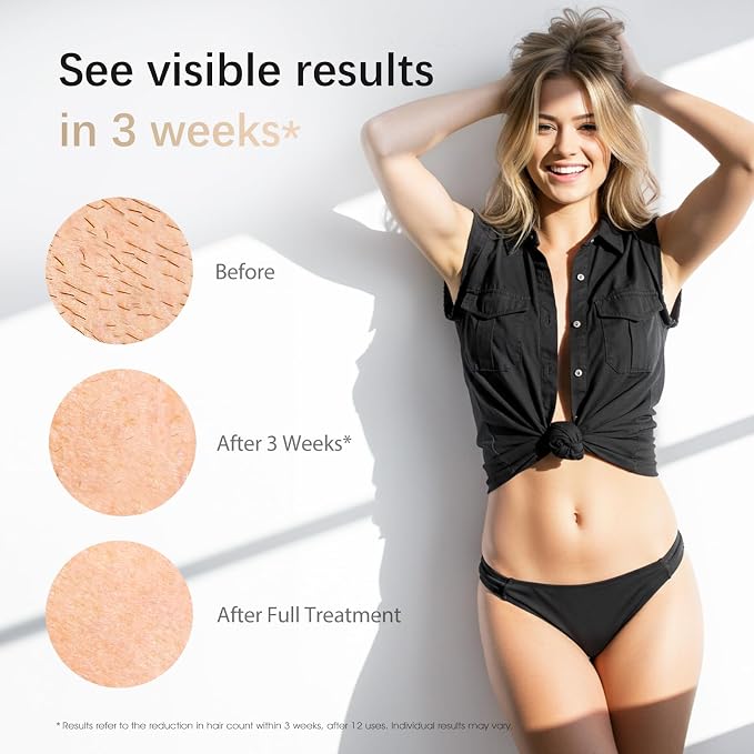IPL Laser Hair Removal Device for Women & Men - Safe At-Home 45°F Ice-Cooling Contact for Painless & Long-Lasting Results, 86% Less Hair In 3 Weeks for Full Body & Face, Off-White