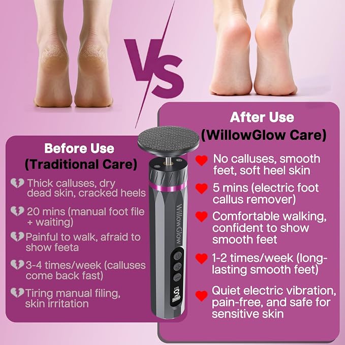 Professional Electric Foot Callus Remover, 9-Speed Cordless Foot File with Reusable Nano Glass Heads & Sandpaper for Dead Skin Removal and Smooth Feet