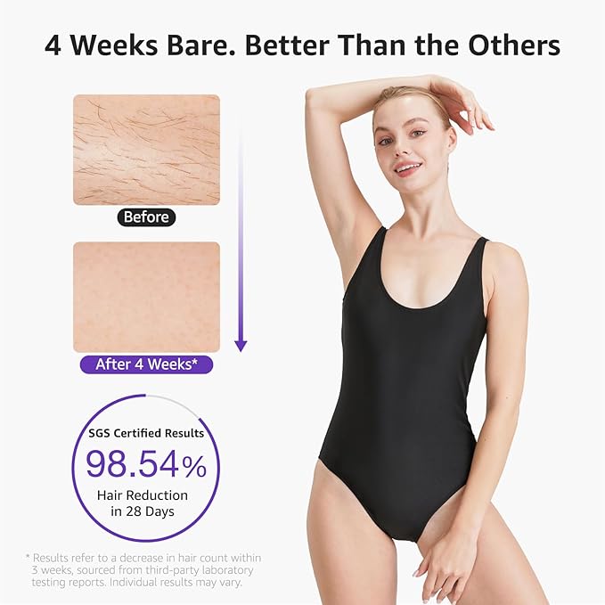 IPL Laser Hair Removal Device For Women: Permanent Hair Removal with Ice Cooling, Safe Skin Sensor & Auto Flashing & Nearly Painless & Long-Lasting Results For Fast Full Body, Holiday Gifts