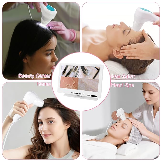 Beauty Star 7-Inch Scalp & Skin Analyzer with 50X/200X Dual Lenses, 4-Split View & 16GB Storage – HD Trichology Microscope Camera for Professional Salon, Head Spa, and Home Hair Follicle Health