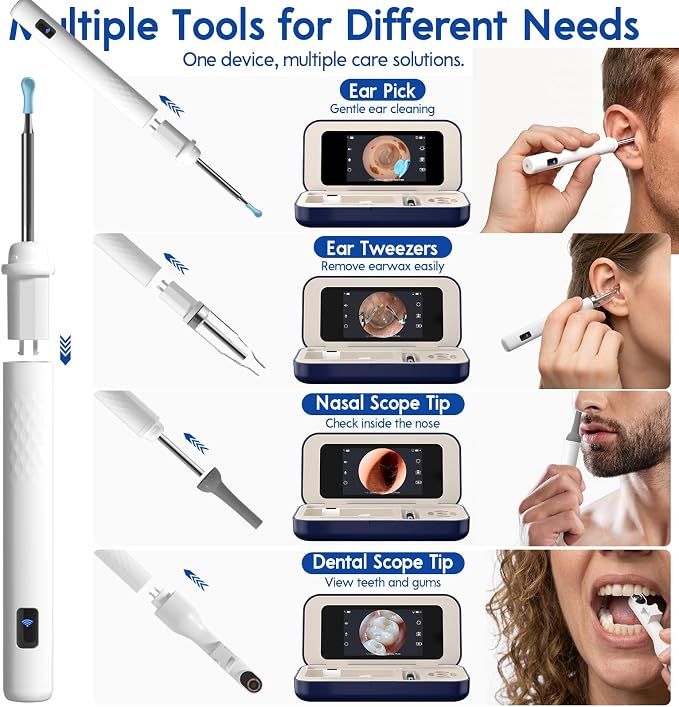 Ear Cleaner with Camera, Wireless Ear Wax Removal Tool with Screen, Visual Ear Cleaner Kit with Tweezers and Replacement Tips, Safe Ear Cleaning Tool for Kids & Adults