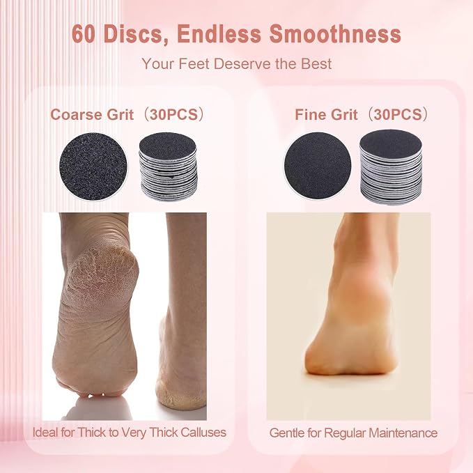 Electric Foot File 2026 Upgrades Foot Callus Remover,Electric Callus Remover for Feet with 60 Pcs Sandpaper Discs, Foot File with Speed Controller,for Dead Dry Crack Skin Calluses