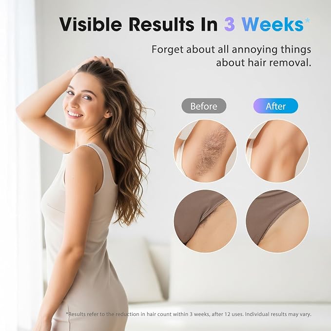 IPL Laser Hair Removal Device for Women & Men - Home 45°F Ice-Cooling Contact for Painless & Long-Lasting Results, 86% Hair Reduction in 3 Weeks for Full Body & Bikini Line, Yellow