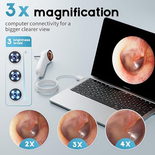 Otoscope Ear Camera with 1.21” Screen, 1080P Ear Scope with 4 LED Lights, Otoscope Camera for Adults, Support Photo & Video, Type-C Charging with Computers, Baby Essentials, Home Medical | 1.21" Screen for real-time viewing. Capture photos and videos, ...