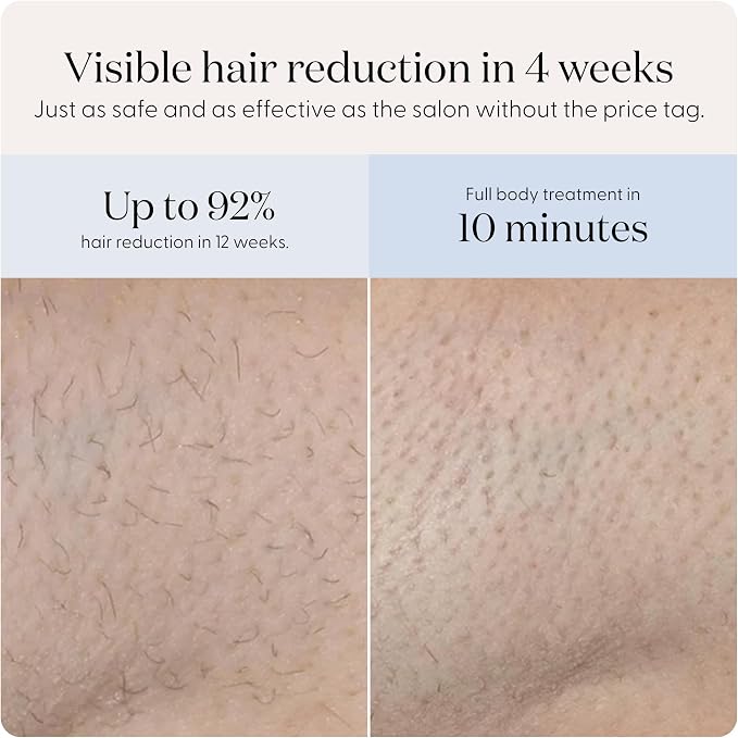 SmoothSkin Pure Mini Lite IPL Blue Hair Removal Device – Compact At-Home Laser Hair Removal for Women, Safe for Face & Body, Permanent Hair Reduction, Gentle & Painless, Salon-Quality Results