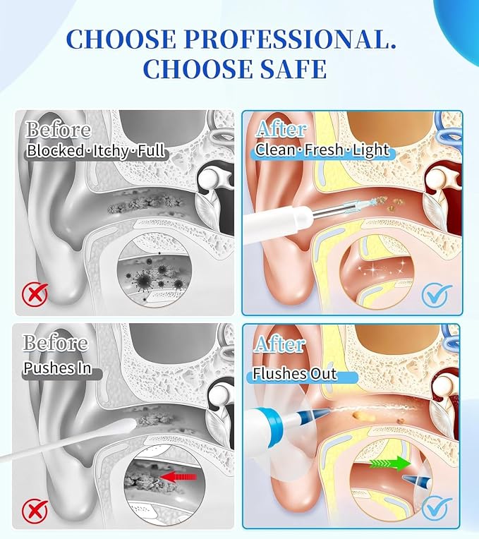 Ear Wax Removal, Earwax Removal Kit for Safe Solo Use at Home, Ear Cleaning Tools with 4 Pressures Modes & LED Light, Includes Basin, Towel & 16 Tips