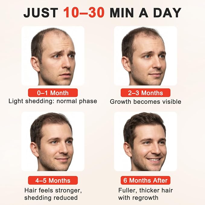 Red Light Therapy for Hair Growth,528 Total Light Emitters,Full-Scalp Coverage,Laser Hair Growth Cap,Blue