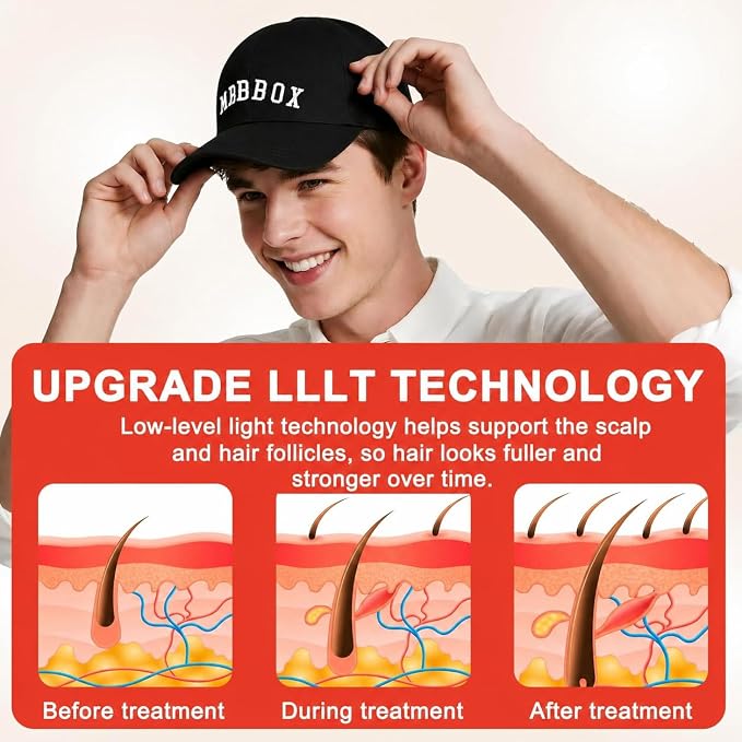 Red Light Hair Growth Cap, 528 Total Light Emitters, Red Light Therapy for Hair,At-Home Scalp Care for Men & Women,Gift Idea,Adjustable Comfort Disgn,Black Cap