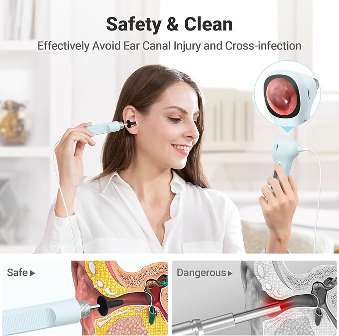 ScopeAround Digital Otoscope w/IPS Screen, 720p HD Smart Video Otoscope with Light, Ear Scope Otoscope with Camera Ear Wax Removal Camera, Ear Checker, Power On and Go (Blue)