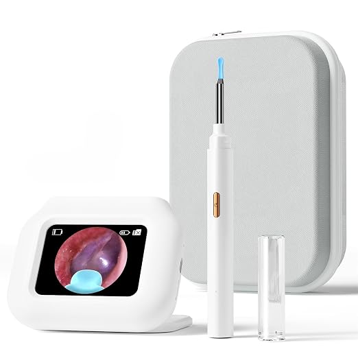 Ear Wax Removal Tool Camera with Screen, Smart Screen Ear Wax Removal Kit with 2.8'' HD Display, WiFi Automatic Connect - Ear Cleaner Tool with Camera&Screen, 6 Replaceable Tips, No App/Phone Needed