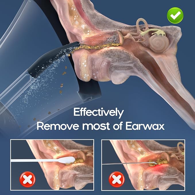 Ear Wax Removal, Electric Ear Cleaning Kit Effective & Safe Ear Cleaner Irrigation Flushing System 4 Pressure Modes for Ear Wax Buildup, Water Resistant Ear Cleaning Tool USB Rechargeable